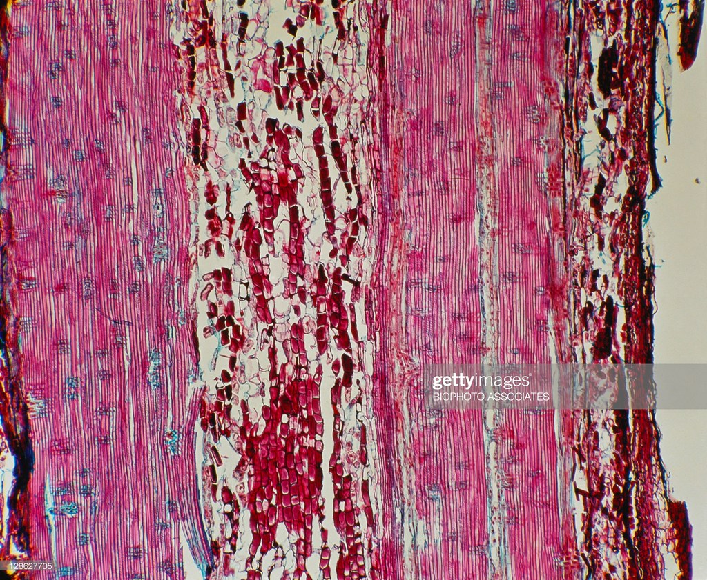 A Section of a Young Pine Stem — illustrating safe stem cells